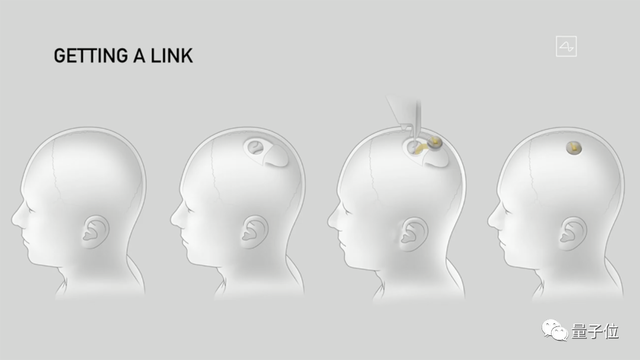 馬斯克最新芯片：腦機專用，讓失明人群“看見”