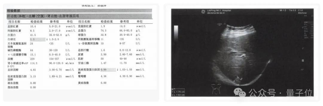 實測醫(yī)療APP好伴AI：數(shù)字版三甲專家人人可用，AI醫(yī)療落地之路終于走通了？